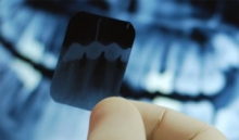 Radiografie dentara