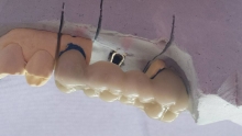 Stomatolog Tancabesti Cabinet Stomatologic Happy Smile - Dr. Cotrut Gratiela
