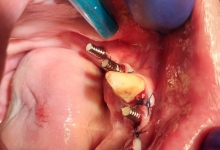 Stomatolog Campulung Muscel Cabinet Stomatologie Campulung Muscel  - Clinica Dr. Gupta