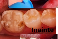 Stomatolog Mioveni Cabinet Stomatologie Mioveni  - Clinica Dr. Gupta