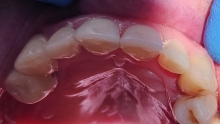 Stomatolog Mioveni Cabinet Stomatologie Mioveni  - Clinica Dr. Gupta