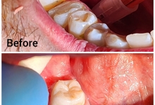 Stomatolog Mioveni Cabinet Stomatologie Mioveni  - Clinica Dr. Gupta