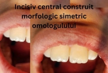 Stomatolog Mioveni Cabinet Stomatologie Mioveni  - Clinica Dr. Gupta