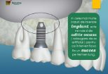 Stomatolog Jilava Consultatii Implanturi Dentare Jilava