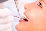 Stomatolog Jilava Consultatii Implanturi Dentare Jilava