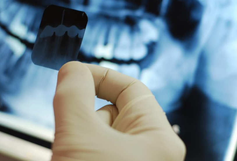 radiografii dentare