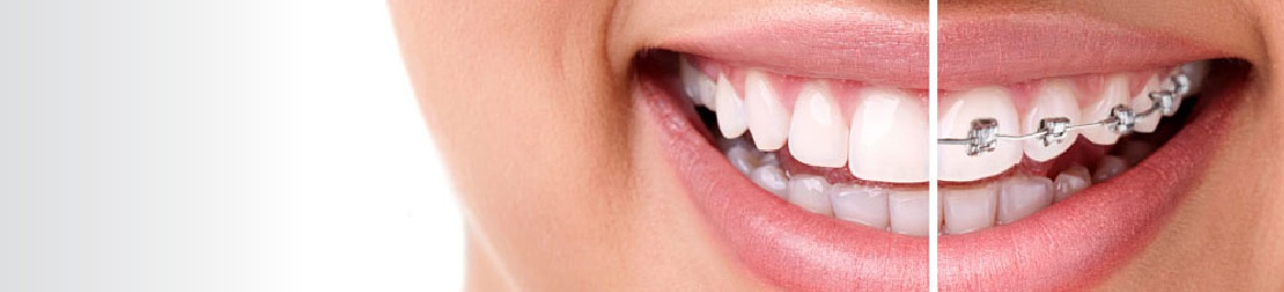 aparat dentar nasaud