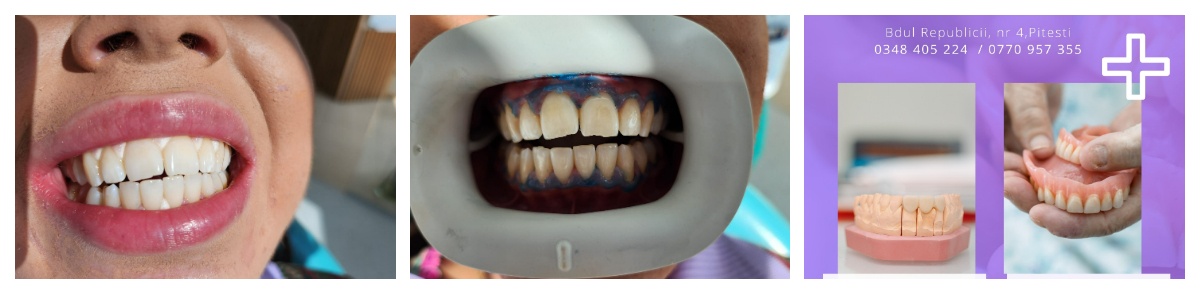 fotojet_5_1200